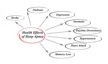  Health Effects of Sleep Apnea clipart