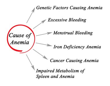 Altı anemi nedenleri