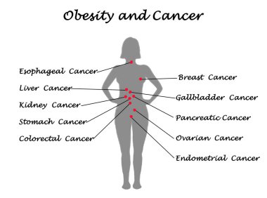 Obezite bir faktör olarak birçok kanser
