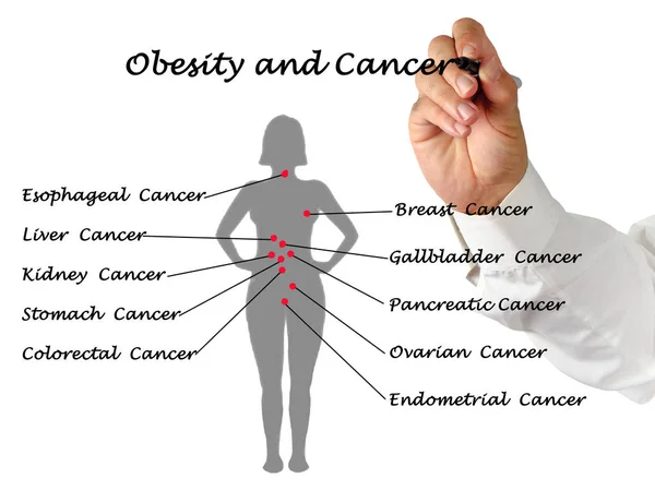 Kobieta, otyłości i raka — Zdjęcie stockowe