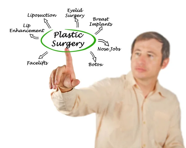 Диаграмма пластической хирургии — стоковое фото