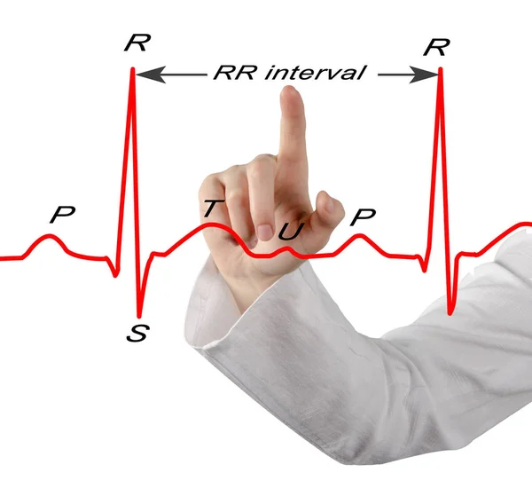 Mujer que presenta ECG marcado — Foto de Stock