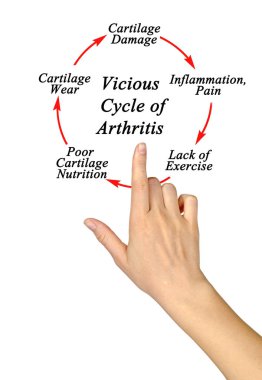 Vicious Cycle of Arthritis 'teki Adımlar