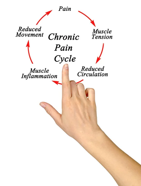慢性疼痛周期的步骤 — 图库照片