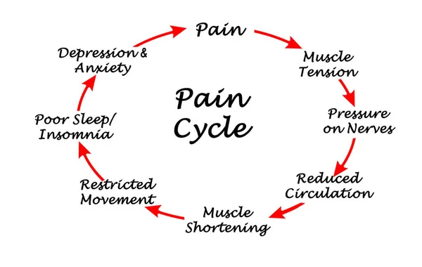 疼痛循环的八个步骤 — 图库照片