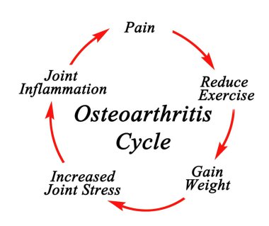 Osteoartrit döngüsünün beş bileşeni