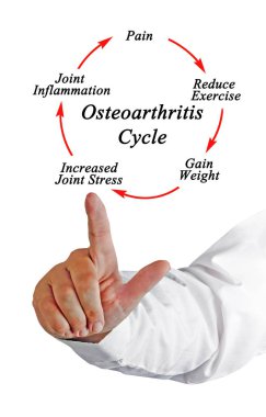 Osteoartrit döngüsünün beş bileşeni