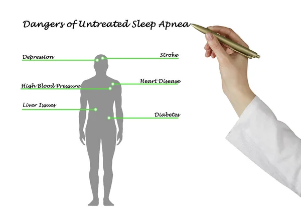 Опасность необработанного апноэ сна — стоковое фото
