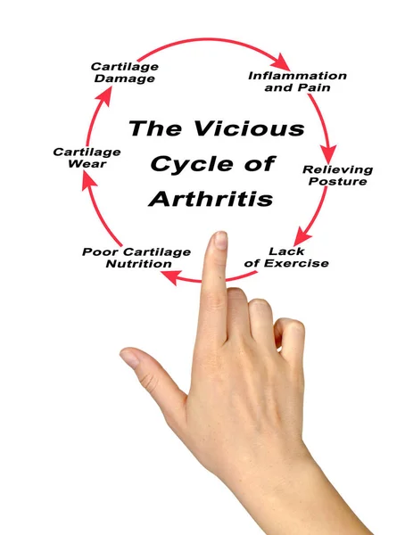 Passos Ciclo Vicioso Artrite — Fotografia de Stock