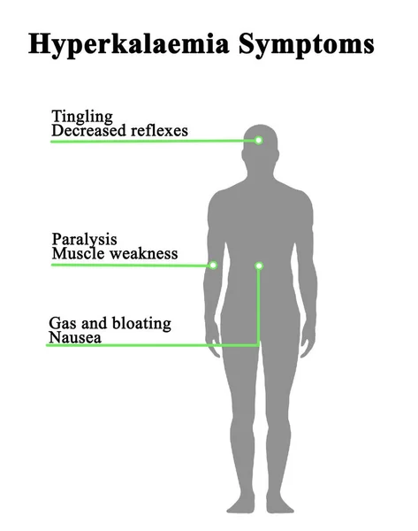 Six Symptoms Hyperkalaemia — Stock Photo, Image