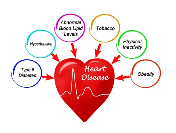 Six Causes Maladies Cardiaques — Photo