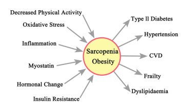  Sarcopenia Obezitesinin Sebepleri ve Sonuçları