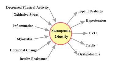  Causes and Consequences of Sarcopenia Obesity clipart