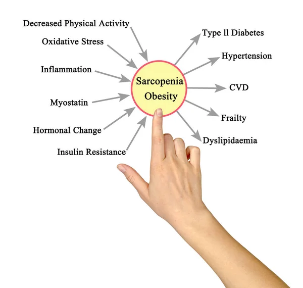Causas Consecuencias Sarcopenia Obesidad — Foto de Stock