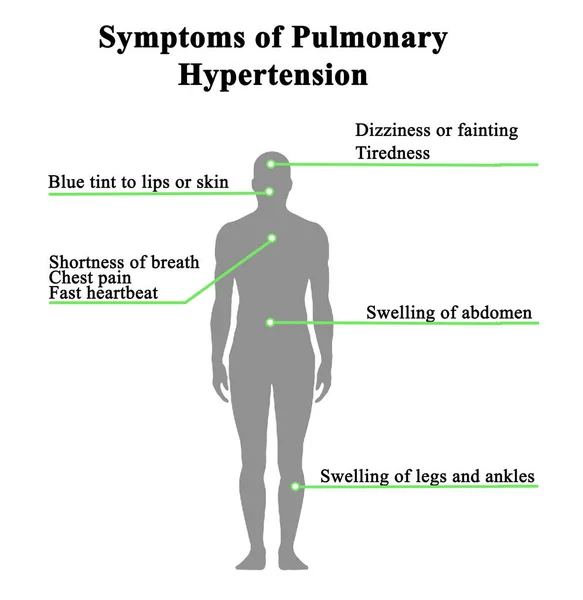 Ocho Síntomas Hipertensión Pulmonar —  Fotos de Stock