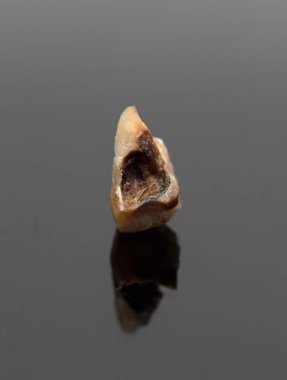 Siyah arka planda insan dişi var..