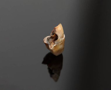 Siyah arka planda insan dişi var..