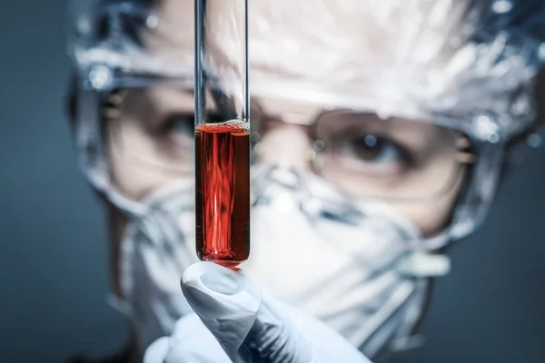 Pozitivní Vzorek Krve Ruce Lékaře Vybrané Zaměření Koronavirová Pandemie — Stock fotografie