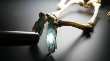 İskelet Mini modeli