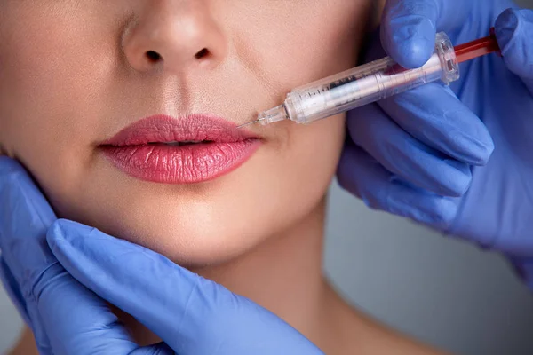 Close up van lippen botox — Stockfoto