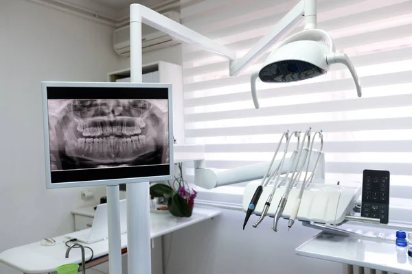 Imagens de raios-X dos dentes do paciente em ambulância dentária — Fotografia de Stock