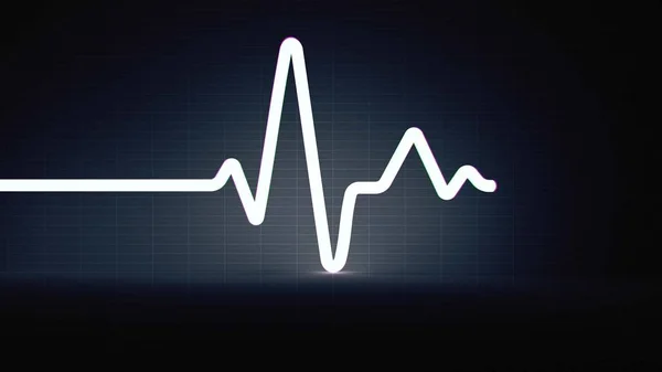 EKG-illustration hjärtrytm — Stockfoto