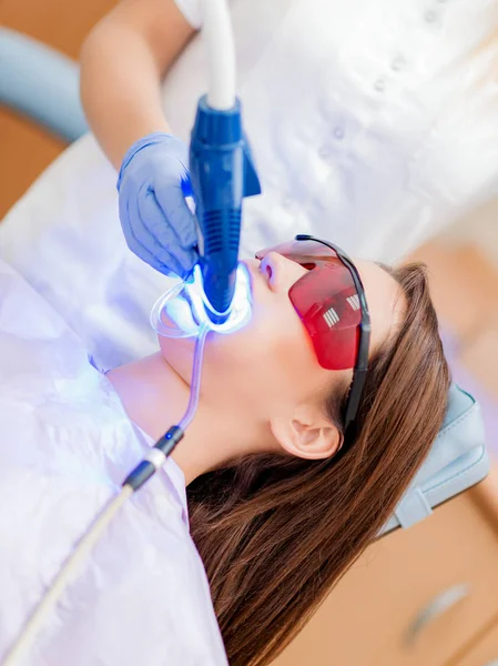 Clareamento dos dentes laser — Fotografia de Stock