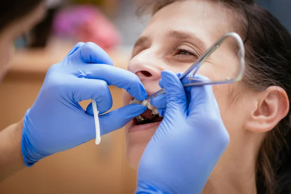 Zubař kontrola závorky na složené závorky — Stock fotografie