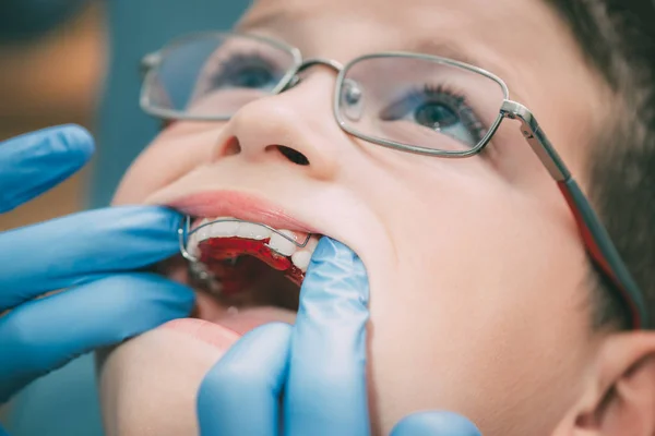 Dental correction to the child patient — Stock Photo, Image