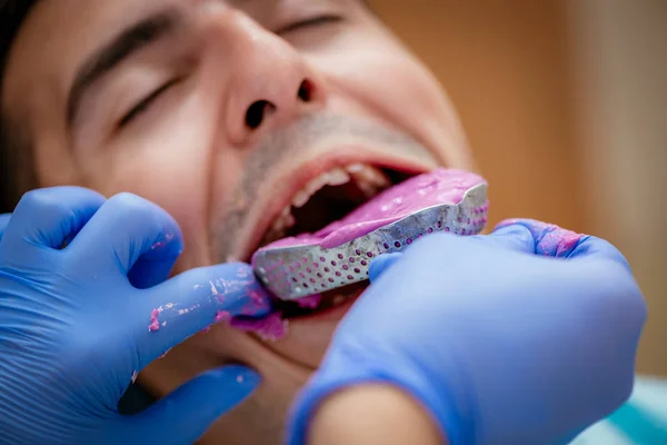 Dentista usando impresión dental para aparatos ortopédicos — Foto de Stock