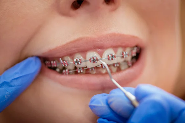 Zahnarzt überprüft Halterung Stockbild