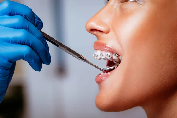 Primer Plano Dentista Revisando Frenos Con Espejo Dental Paciente Joven — Foto de Stock