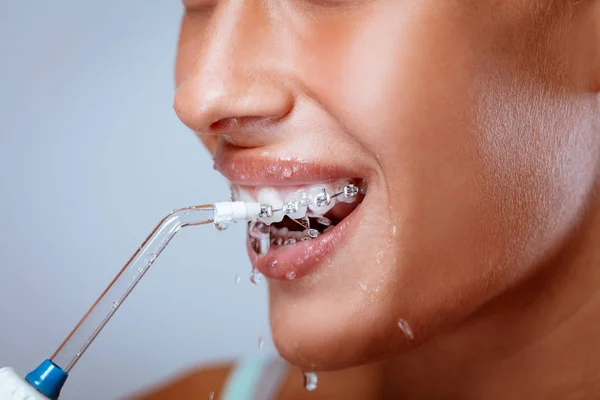 Yakın çekim oral irrigator ile dişlerini Temizleme diş telleri ile gülümseyen bir kadın yüz. 