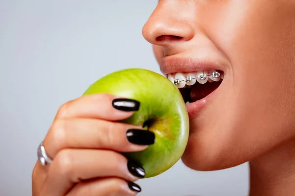 Primer Plano Una Cara Niña Sonriente Con Frenos Dientes Blancos — Foto de Stock