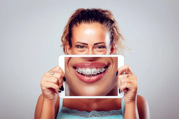 Menina Sorridente Com Aparelho Nos Dentes Atrás Tablet Digital Olhando — Fotografia de Stock