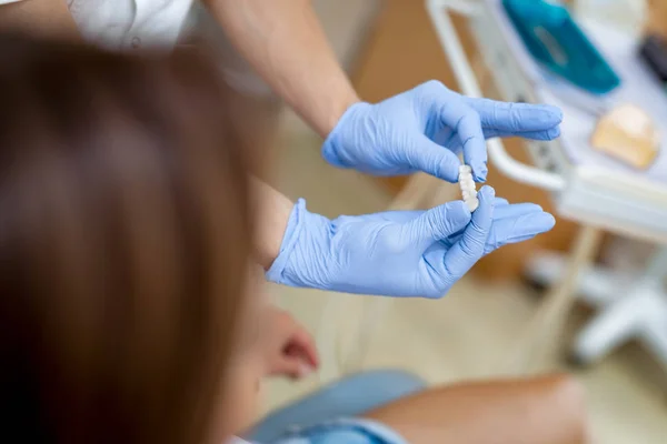 Vista Próxima Dentista Mostrando Coroas Porcelana Para Paciente — Fotografia de Stock