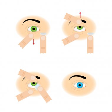 Kontakt lens kullanımı için yönergeler.