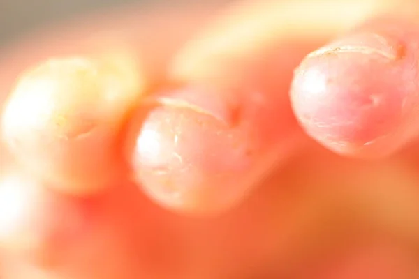 Онихофагия Укушенные Ногти Ребенке — стоковое фото