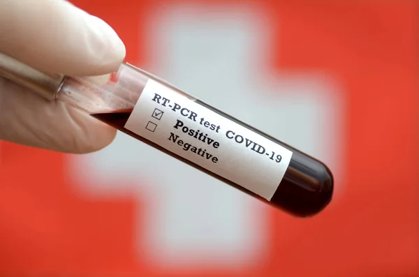 コロナウイルス2019 Ncov血液サンプル 流行性ウイルス呼吸器症候群ストックフォト スイスでコロナウイルスが発生 血液検査付き保持管のストックフォト 小説コロナウイルス2019病気 Covid Ncv — ストック写真