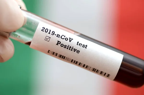 Campione Sangue Coronavirus 2019 Ncov Virus Epidemico Sindrome Respiratoria Foto — Foto Stock