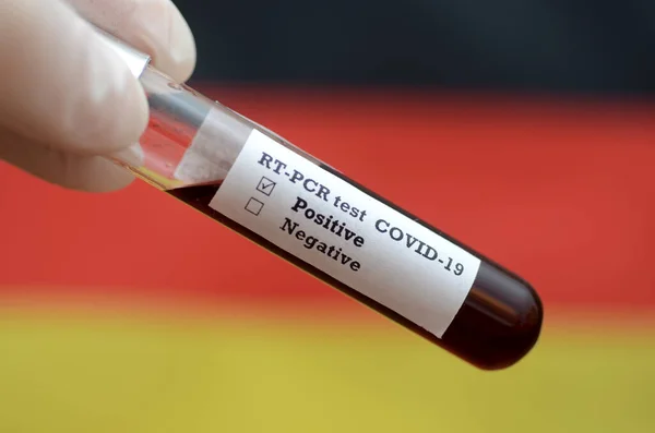 Coronavirus 2019 Ncov Blood Sample Епідемічний Вірус Респіраторний Синдром Вірус — стокове фото