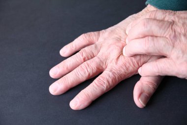 Yaşlı adam parmaklarını bir elin üstüne bastırır.