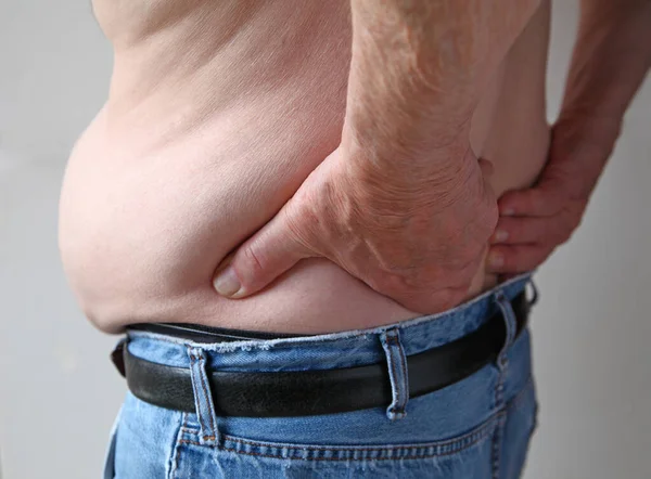 Man Distended Belly Has His Hands His Aching Back — Stok Foto
