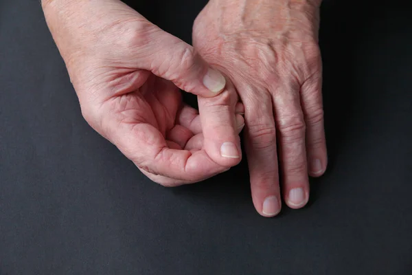 Kopya Alanı Olan Yaşlı Bir Adamın Elindeki Parmak Eklem Ağrısı — Stok fotoğraf
