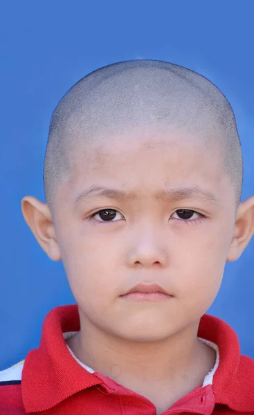Seorang Anak Kecil Botak Kepala Dengan Ekspresi Wajah — Stok Foto