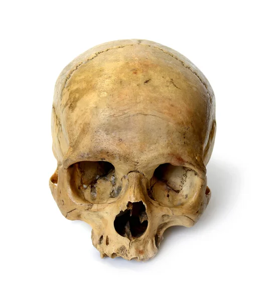 Crânio humano sobre um fundo branco. — Fotografia de Stock