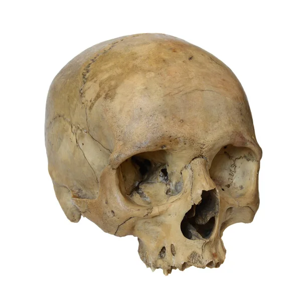 Crânio humano sobre um fundo branco. — Fotografia de Stock