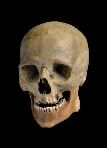 Az emberi koponya — Stock Fotó