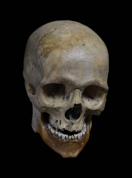 Skull of the human — Stock Photo, Image