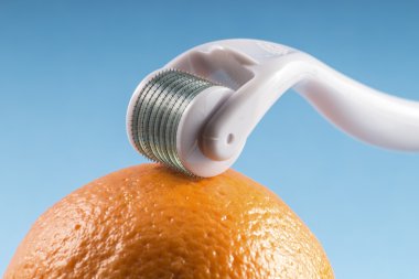 Derma roller için tıbbi mikro terapi ile portakal iğneleme yöntemlerinin etkinliğinin karşılaştırılması.